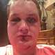 Illustration for article titled MLB Prospects Lawyer Releases Graphic Photos After Alleged Assault